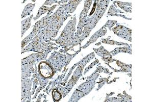 IHC analysis of H Cadherin/CDH13 using anti-H Cadherin/CDH13 antibody (ABIN7600095).
