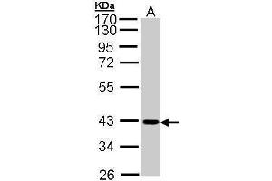 WB Image Sample (30 ug of whole cell lysate) A: A431 , 12 % SDS PAGE antibody diluted at 1:1000