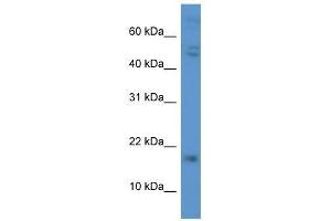 Western Blot showing CGB antibody used at a concentration of 1. (CGB anticorps  (C-Term))