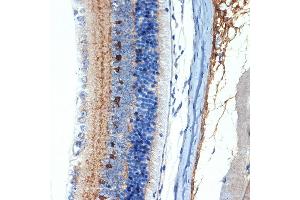 Immunohistochemistry of paraffin-embedded mouse retina using CR Rabbit mAb (ABIN7266269) at dilution of 1:100 (40x lens).