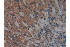 Detection of GSTk1 in Mouse Stomach Tissue using Polyclonal Antibody to Glutathione S Transferase Kappa 1 (GSTk1)