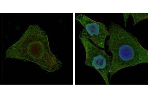 Confocal immunofluorescence analysis of MCF-7 (left) and HepG2 (right) cells using BRAF mouse mAb (green).