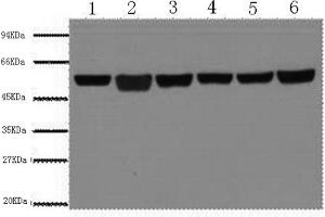 Western Blotting (WB) image for anti-Tubulin, beta (TUBB) antibody (ABIN6566394) (TUBB anticorps)