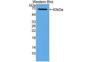 Detection of Recombinant XDH, Human using Polyclonal Antibody to Xanthine Dehydrogenase (XDH)