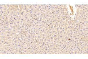 Detection of C3a in Mouse Liver Tissue using Polyclonal Antibody to Complement Component 3a (C3a) (C3a anticorps  (AA 671-748))
