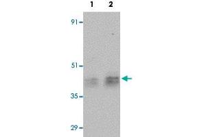 Western blot analysis of human testis tissue with ESX1 polyclonal antibody  at (Lane 1) 1 and (Lane 2) 2 ug/mL dilution. (ESX Homeobox 1 anticorps)