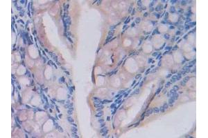 Used in DAB staining on fromalin fixed paraffin- embedded testis tissue (Fatty Acid Synthase anticorps  (AA 2257-2504))