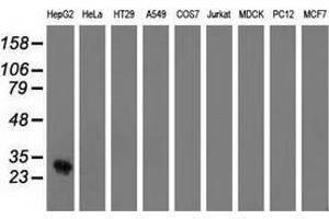 Western blot analysis of extracts (35 µg) from 9 different cell lines by using anti-OTUB2 monoclonal antibody. (OTUB2 anticorps)