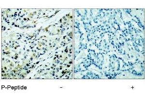 Image no. 1 for anti-Histone Deacetylase 5 (HDAC5) (pSer498) antibody (ABIN196932) (HDAC5 anticorps  (pSer498))