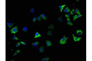 Immunofluorescence staining of SH-SY5Y cells with ABIN7139719 at 1:100, counter-stained with DAPI. (SNCA anticorps  (AA 119-136))