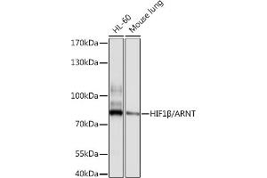 Western blot analysis of extracts of various cell lines, using HIF1β/ARNT antibody (ABIN3021190, ABIN3021191, ABIN3021192 and ABIN6214058) at 1:1000 dilution. (ARNT anticorps  (AA 400-500))