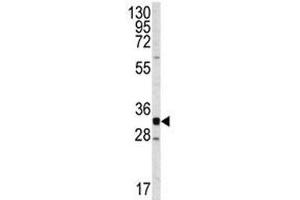 Western blot analysis of CDK2 antibody and Jurkat lysate.