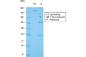 SDS-PAGE Analysis of Purified TIMP1 Rabbit Recombinant Monoclonal Antibody (TIMP1/1944R). (Recombinant TIMP1 anticorps)
