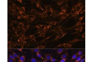 Immunofluorescence analysis of C6 cells using PREPL Polyclonal Antibody at dilution of 1:100 (40x lens).