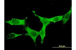 Immunofluorescence of monoclonal antibody to DCAMKL1 on NIH/3T3 cell.