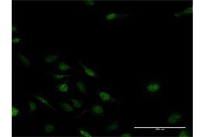 Immunofluorescence of purified MaxPab antibody to MSX2 on HeLa cell.