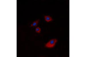 Immunofluorescent analysis of Cytokeratin 20 staining in A549 cells.