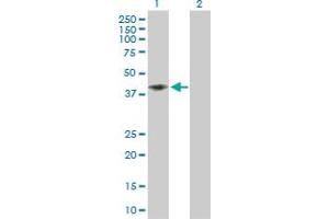 Western Blot analysis of CD58 expression in transfected 293T cell line by CD58 MaxPab polyclonal antibody. (CD58 anticorps  (AA 1-250))