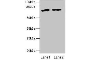 Western blot All lanes: ENOX1 antibody at 5 μg/mL Lane 1: Jurkat whole cell lysate Lane 2: Raji whole cell lysate Secondary Goat polyclonal to rabbit IgG at 1/10000 dilution Predicted band size: 74, 28 kDa Observed band size: 74 kDa (ENOX1 anticorps  (AA 101-340))