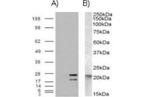 Image no. 1 for anti-GTPase NRas (NRAS) (Internal Region) antibody (ABIN375000) (GTPase NRas anticorps  (Internal Region))