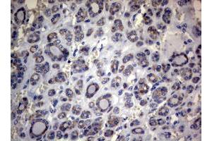 Image no. 3 for anti-Mitofusin 1 (MFN1) (AA 209-469) antibody (ABIN1491184) (MFN1 anticorps  (AA 209-469))