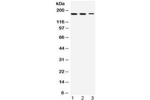 Western blot testing of 1) rat testis, 2) mouse testis and 3) human HepG2 lysate with KDM5B antibody at 0. (KDM5B anticorps  (AA 641-685))