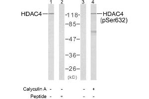 Image no. 1 for anti-Histone Deacetylase 4 (HDAC4) (pSer632) antibody (ABIN196930) (HDAC4 anticorps  (pSer632))