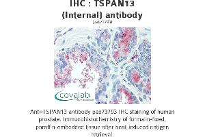 Image no. 1 for anti-Tetraspanin 13 (TSPAN13) (Internal Region) antibody (ABIN1740425)