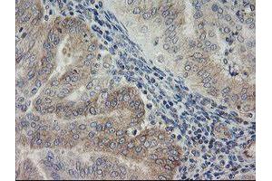 Immunohistochemistry (IHC) image for anti-ATP/GTP Binding Protein 1 (AGTPBP1) (AA 368-753) antibody (ABIN1491460)