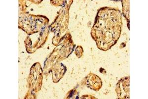 Immunohistochemistry of paraffin-embedded human placenta tissue using ABIN7176020 at dilution of 1:100 (ZBED1 anticorps  (AA 1-210))