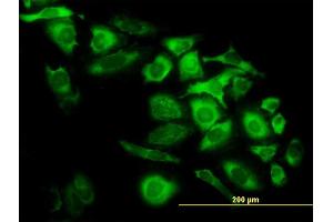 Immunofluorescence of monoclonal antibody to CAPG on HeLa cell. (CAPG anticorps  (AA 249-348))