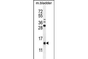 KT Antibody (C-term) (ABIN655129 and ABIN2844756) western blot analysis in mouse bladder tissue lysates (35 μg/lane). (KRTCAP2 anticorps  (C-Term))