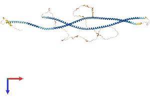 CTAGE Family, Member 8 (CTAGE8) (AA 1-777) protein (His tag)