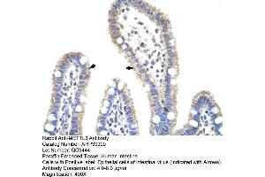 Human Intestine (METTL3 anticorps  (N-Term))