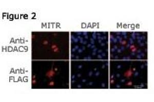 Figure 2: Immunofluorescence staining of MITR for a compartmentalization study in undifferentiated C2C12 myoblasts transfected with a MITR-expressing plasmid.