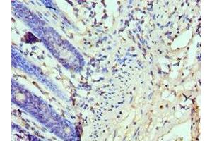 Immunohistochemistry of paraffin-embedded human colon tissue using ABIN7173934 at dilution of 1:100 (TP53BP1 anticorps  (AA 1758-1972))