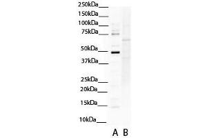 WB Suggested Anti-SOX4 Antibody Titration:  0.