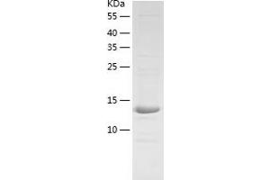 Western Blotting (WB) image for Zinc Finger, HIT-Type Containing 1 (ZNHIT1) (AA 1-154) protein (His-IF2DI Tag) (ABIN7125811)