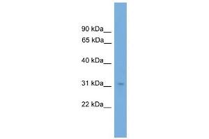 NRBF2 antibody used at 1 ug/ml to detect target protein. (NRBF2 anticorps  (N-Term))
