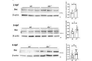 Western blot analysis of Dcc protein levels on extracted brains at 2, 3 and 6 dpf.