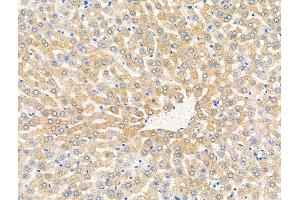 ABIN7094876 and ABIN7098928 at 1/100 staining Rat liver tissue by IHC-P. (MUT anticorps  (N-Term))