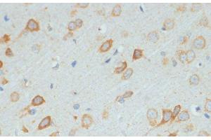 Immunohistochemistry of paraffin-embedded Rat brain using DDX3X Polyclonal Antibody at dilution of 1:100 (40x lens). (DDX3X anticorps)