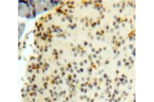 Used in DAB staining on fromalin fixed paraffin-embedded Pancreas tissue (CENPH anticorps  (AA 1-247))
