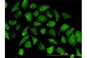 Immunofluorescence of monoclonal antibody to ANXA2 on HeLa cell.