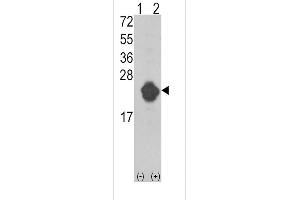 Western blot analysis of IL1RN (arrow) using rabbit polyclonal IL1RN Antibody (Center) (ABIN390396 and ABIN2840788). (IL1RN anticorps  (AA 100-129))