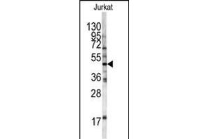 Western blot analysis of HFE antibody (Center) (ABIN390457 and ABIN2840827) in Jurkat cell line lysates (35 μg/lane). (HFE anticorps  (AA 122-148))