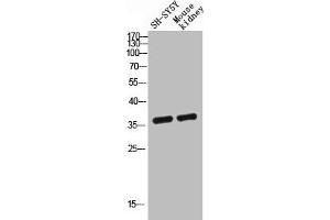 Western blot analysis of SH-SY5Y mouse-kidney lysis using GPR119 antibody. (G Protein-Coupled Receptor 119 anticorps  (Internal Region))