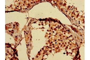 Immunohistochemistry of paraffin-embedded human testis tissue using ABIN7173996 at dilution of 1:100