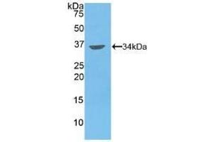 Detection of Recombinant MMP7, Human using Polyclonal Antibody to Matrix Metalloproteinase 7 (MMP7) (MMP7 anticorps  (AA 1-267))
