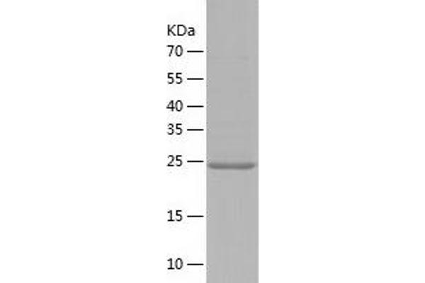 Elastase 3B Protein (AA 28-269) (His tag)